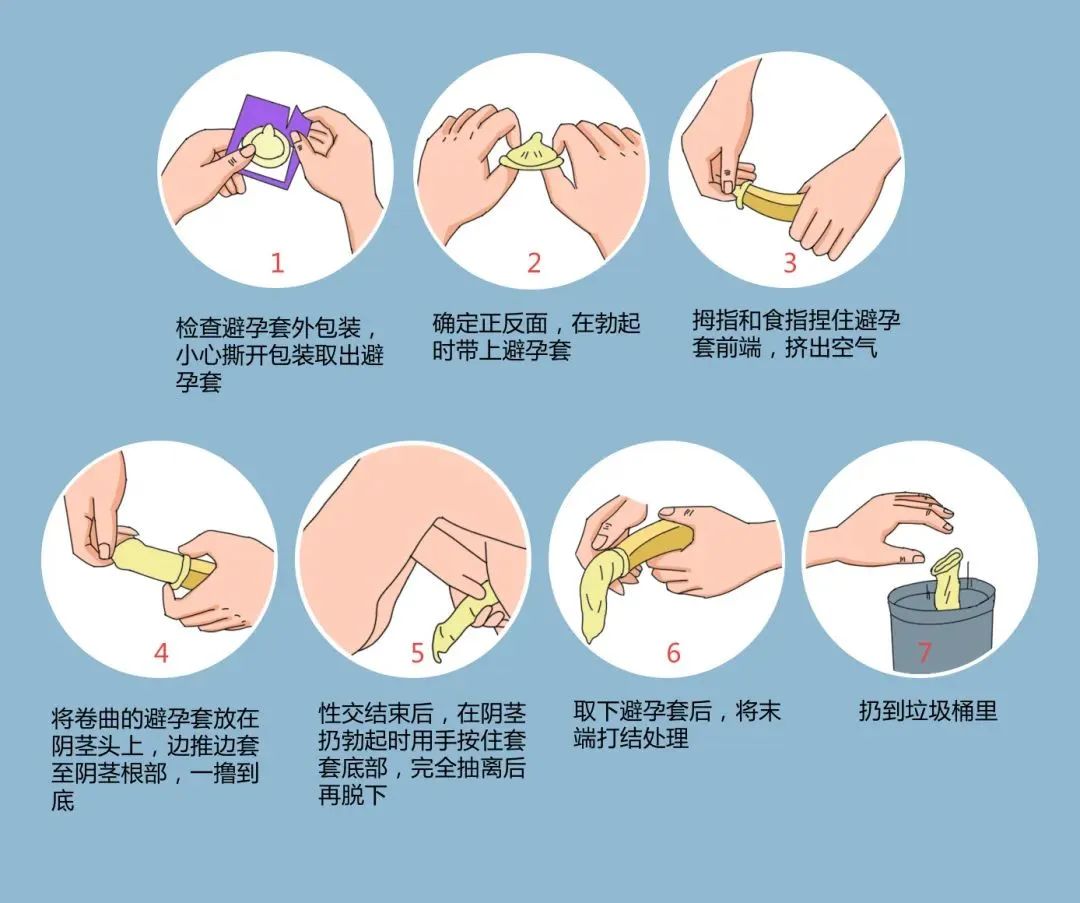 年輕人成艾滋病重災(zāi)區(qū)，正確戴套很有必要.jpg